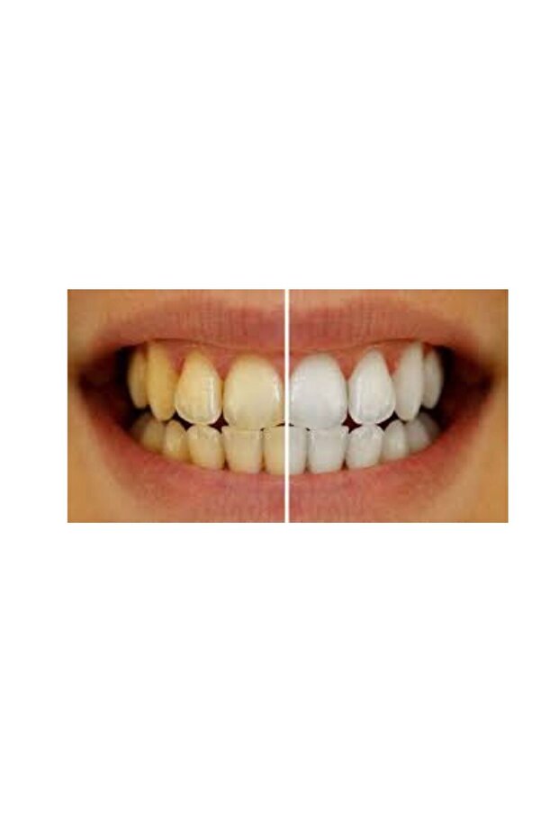 Teeth Whitening Cake 200 Pack - 4