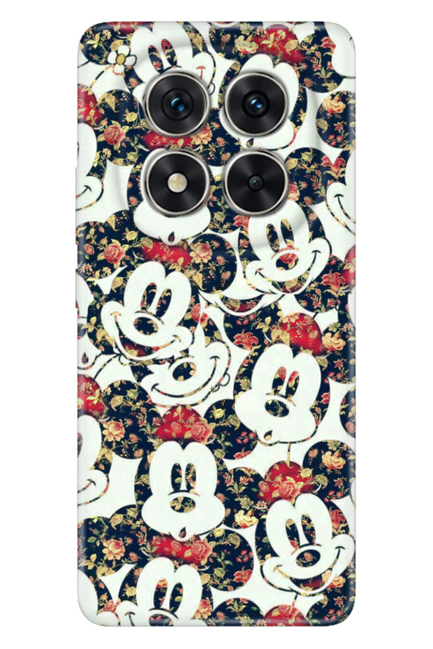 حافظة Redmi Note 15 Pro Plus+ 5G مصنوعة من السيليكون الملون مطبوع TPU Mouse