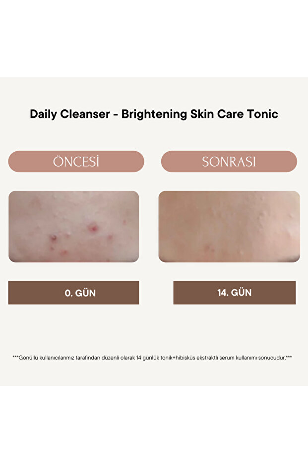 Cilt Bakım Seti - 4