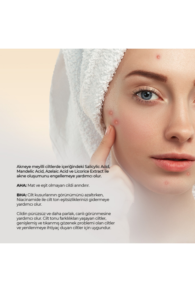 Anti-Acne Serum 30ML - 4