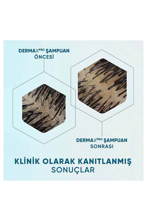 DermaXPRO Yatıştırıcı Kepek Karşıtı Şampuan Aloe Vera Özü ve Seramid ile 300ml - 5