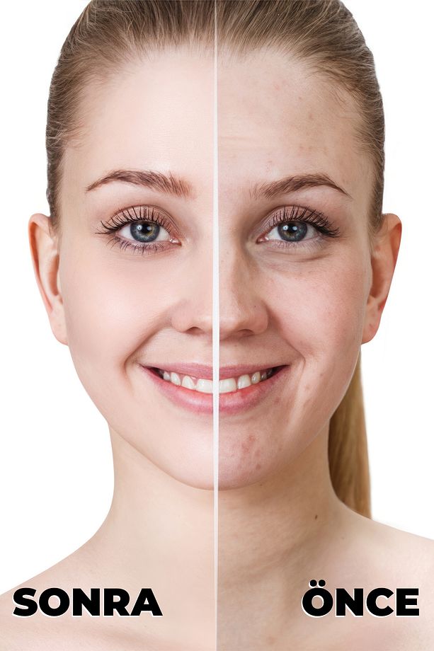 Derma Make-up Cover Tüp Kapatıcı No:3 - 3