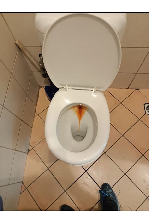 Wc Sarı Leke Temizleme Jeli - Sol Wc Perfect Jel 500ml 2 adet - 5