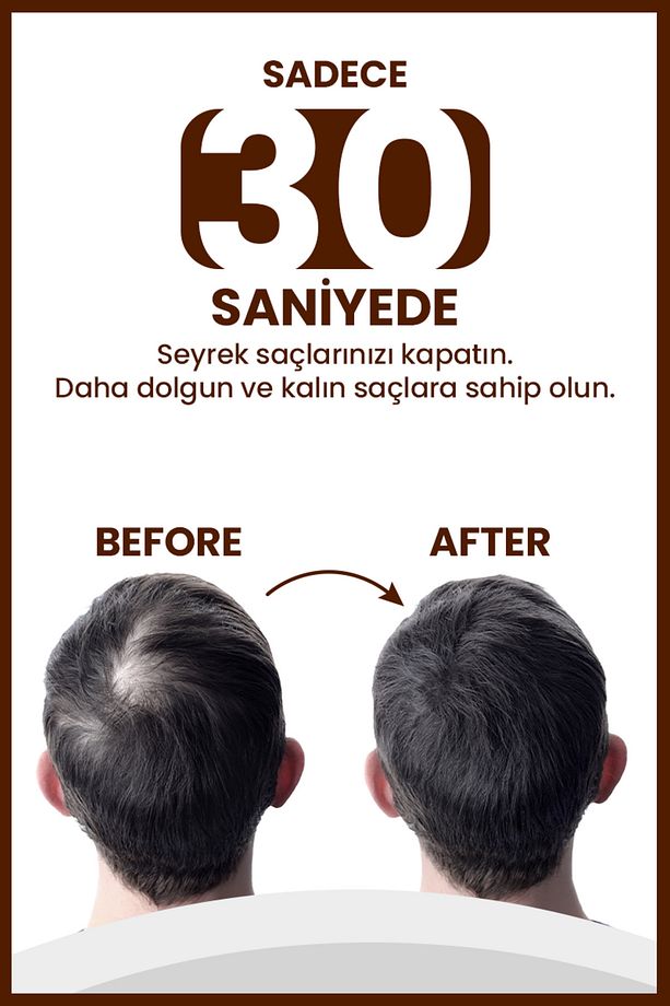 Dolgunlaştırıcı Saç Spreyi Kahverengi | Seyrek Saçları Kapatır & Yoğun Görünüm | 100ml - 4