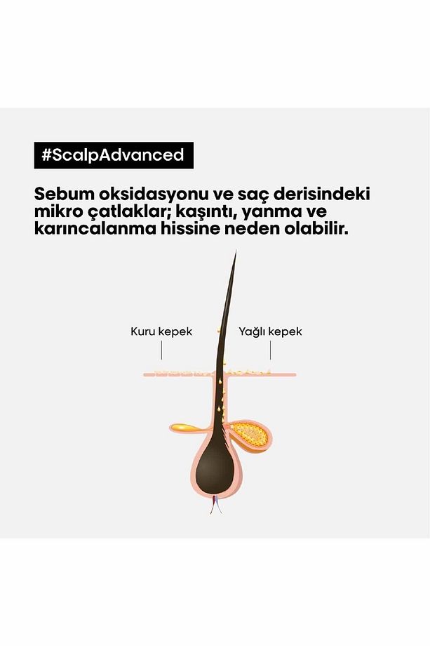 Serie Expert Scalp Advanced Kepek Karşıtı Profesyonel Şampuan 500 ml - 8