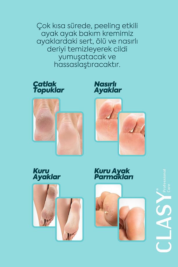 Ayak Ve Topuk Çatlak Kremi, Ayak Bakımı, Ayak Kokusu Ve Topuk 100ml - 6