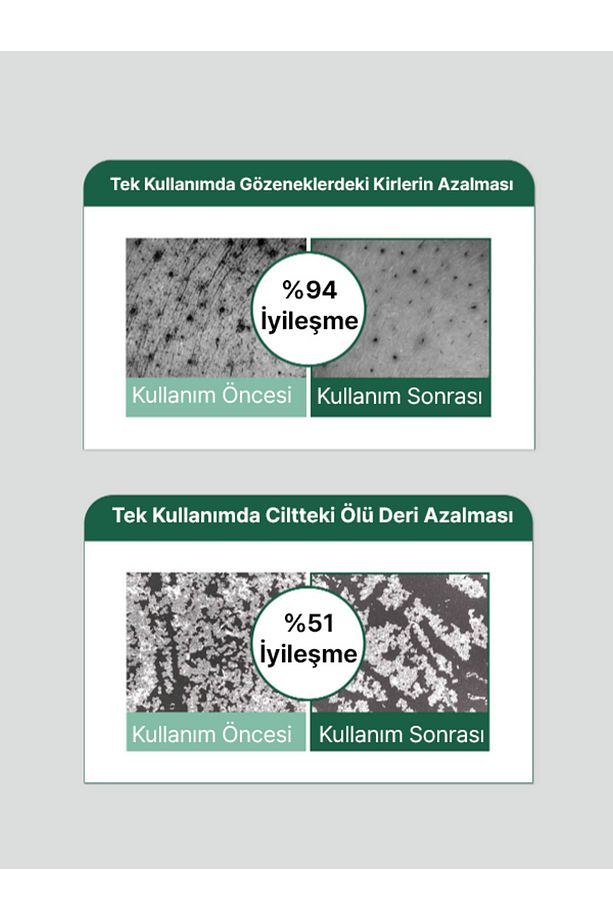 White Tea Tree (KOREANDBEAUTY) Ac Plus Pack Cleanser | Ve Siyah Nokta Karşıtı Temizleme Balmı 100ml - 5