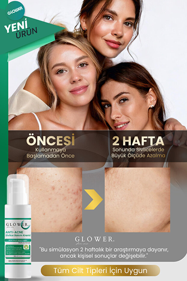 Önleyici, Ve Karşıtı, Akne, Siyah Nokta Leke,giderici, Yüz Kremi 100ML - 2