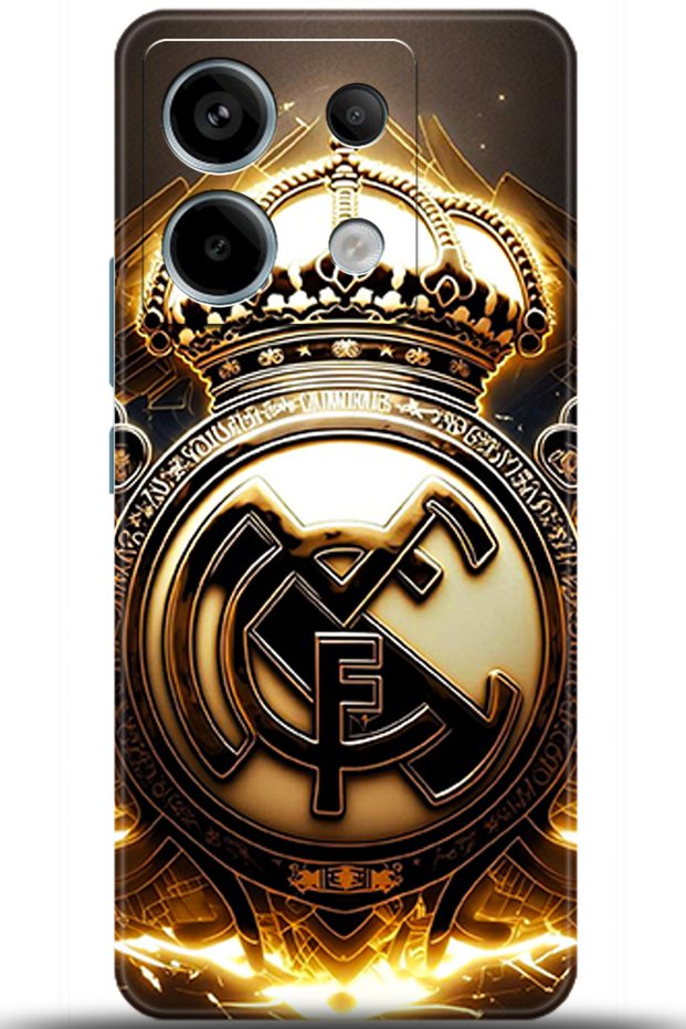 Xiaomi Redmi Note 13 Pro 5g Case Hd Printed Case - Keep Following 5395