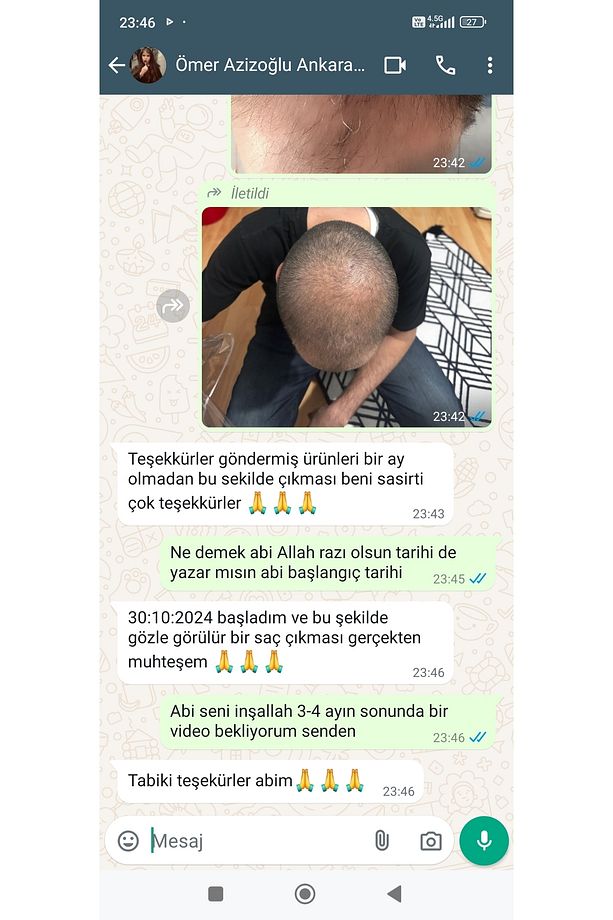 Sarı saç solusyonu - 4