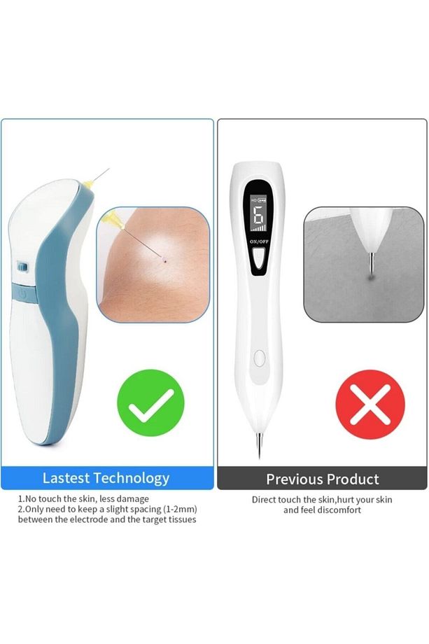 Plexr Plasma Pen Çatlak Ben Siğil Leke Dövme Için En Uygun Ürün - 5