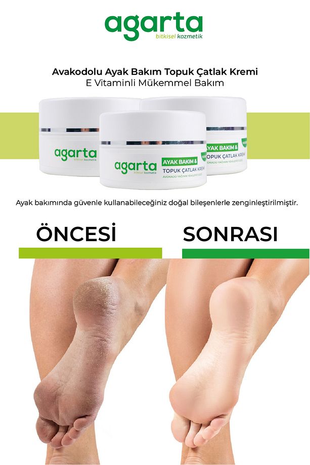 Ayak ve Topuk Çatlak Bakım Kremi 100 Ml - 2