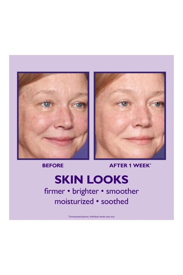 Ultimate Solution 5 Nemlendirici 50 ml - 2