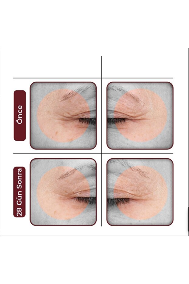 Genesis Formula Intensıve Treatment 30 ml - 6