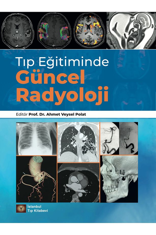 Tıp Eğitiminde Güncel Radyoloji - 2