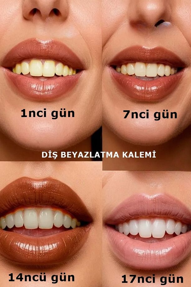 Diş Beyazlatma Kalemi DazWhite 1 Adet - 5