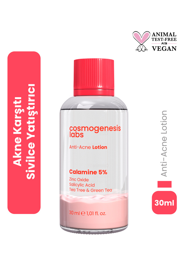 Anti-Acne Drying Lotion 30ml – Soothing Blackhead Reducing Vegan (5% Calamine - Green Tea)