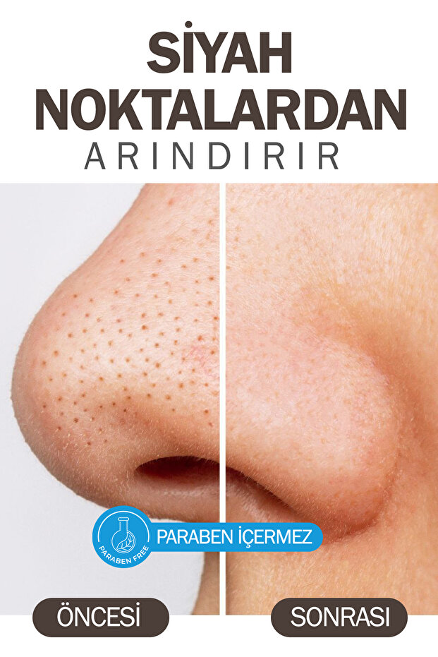 Ölüdeniz Kill Maskesi - 2