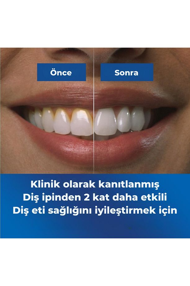 Kablosuz Ağız Duşu, 2024 Test Birincisi, Precision Pulse Teknolojisi - 4