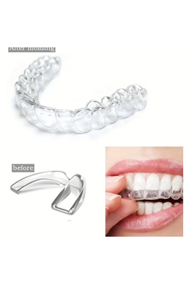 Bruksizm Gece Aparatı Plağı - 1