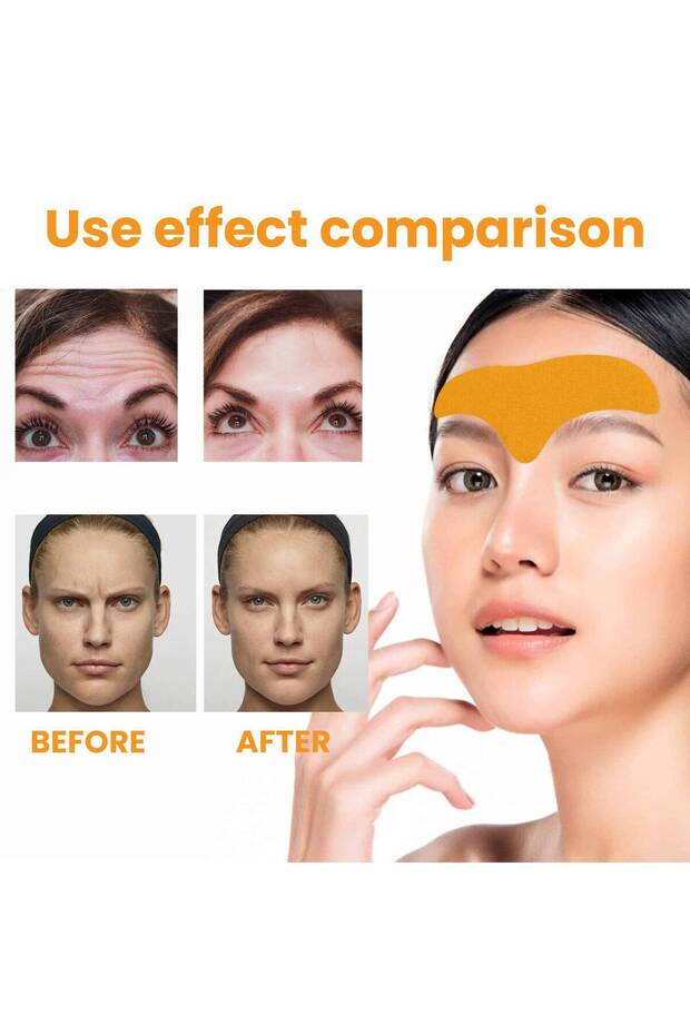 15 Pieces Collagen Supported Wrinkle Removal and Forehead and Smile Line Tapes Set - 2