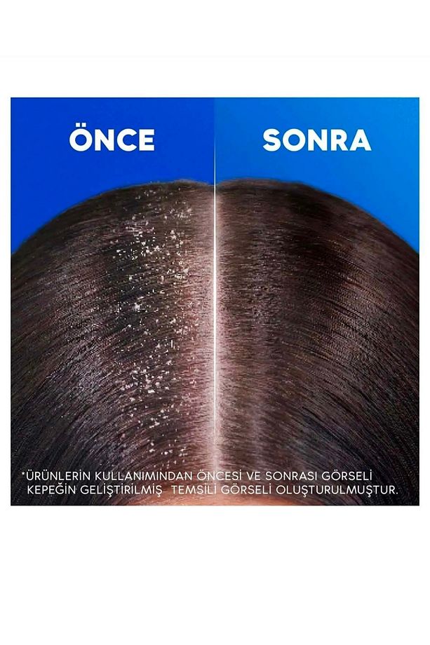 Head And Shoulders Şampuan Klasik Bakım 1in1 330 ml X 6 Adet - 4