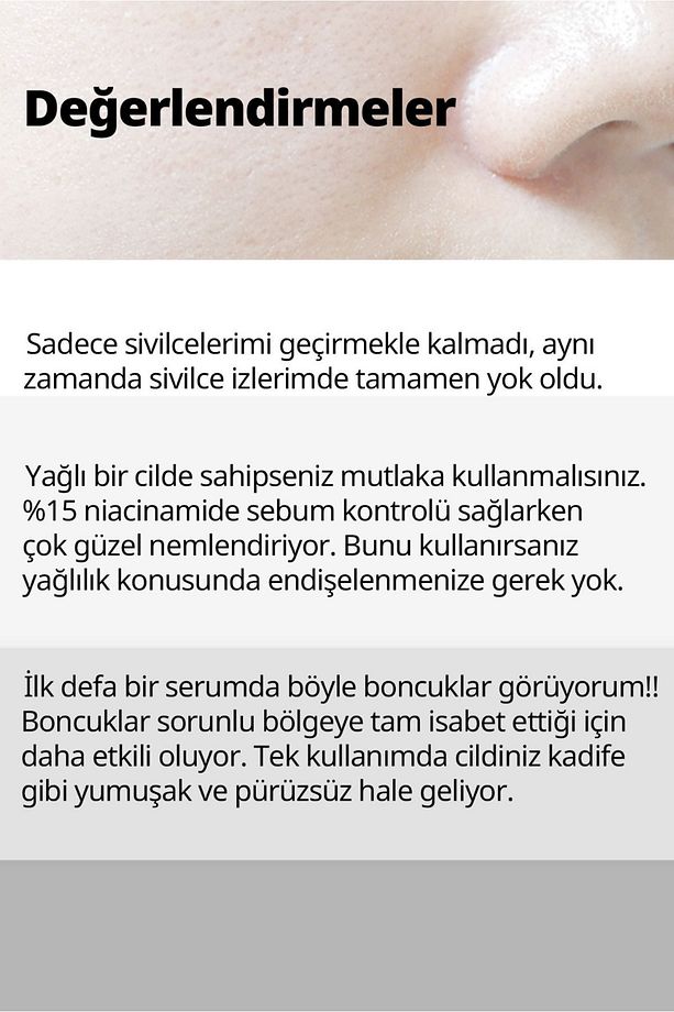 15% Niacinamide ve Çinko Boncukları İçeren Gözenek Serumu 30ml - 4