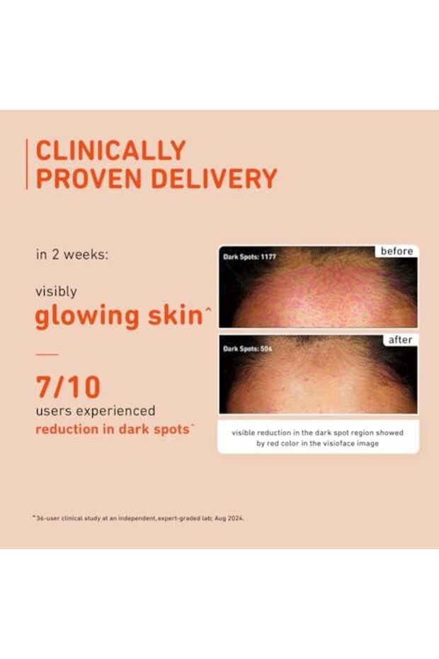 15% Vitamin C Face Serum For Glowing Skin | Non Irritating Formula | For Dull Skin | With Manda - 6
