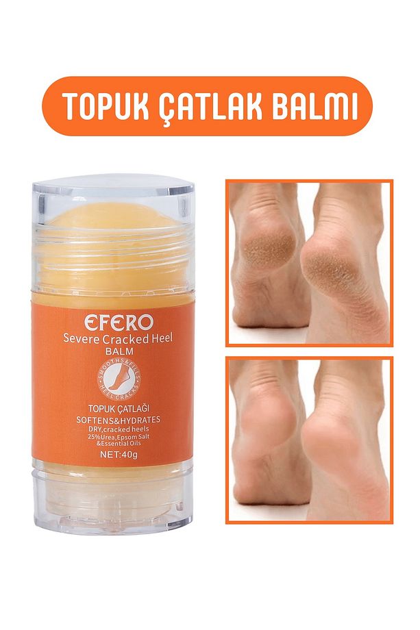 Kuru Ve Yıpranmış Ayaklar & Topuklar İçin Ayak Ve Topuk Kremi 40g - 1