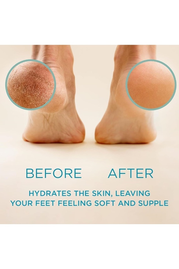 Ayak Topuk Nasır Giderici - Callus Eliminator 100 ml - 3