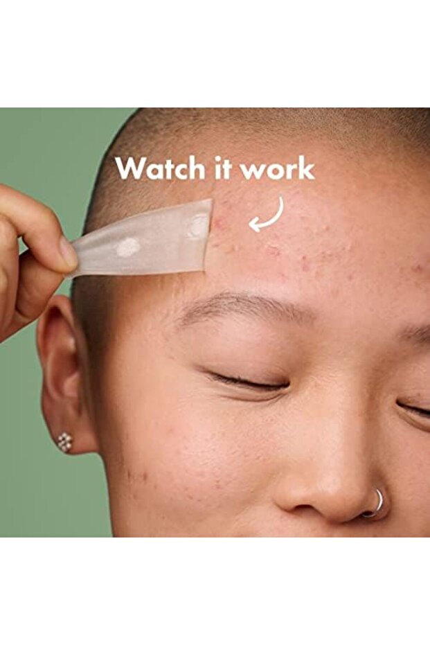 السطح - رقعة هيدروكولويد لعلاج حب الشباب الكبير (10 قطع) - 5