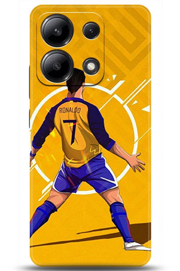 Xiaomi Redmi Note 13 4g Case Hd Printed Case - Like You Series 5093