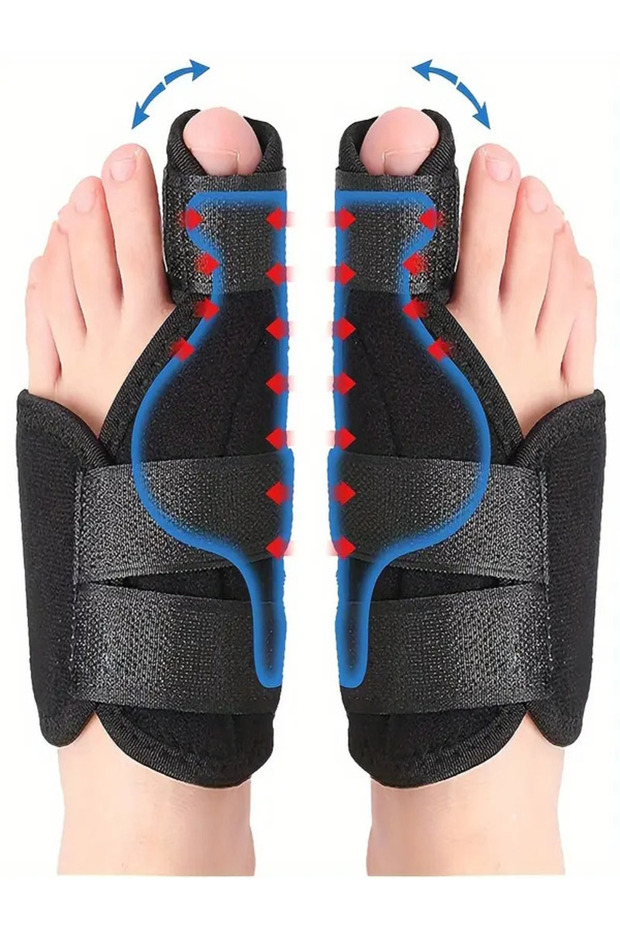 1 Çift Ayak Baş Parmak Düzeltici Kemik Çıkıntısı Için Aparat Ayak Parmak Ateli Halluks Valgus - 8