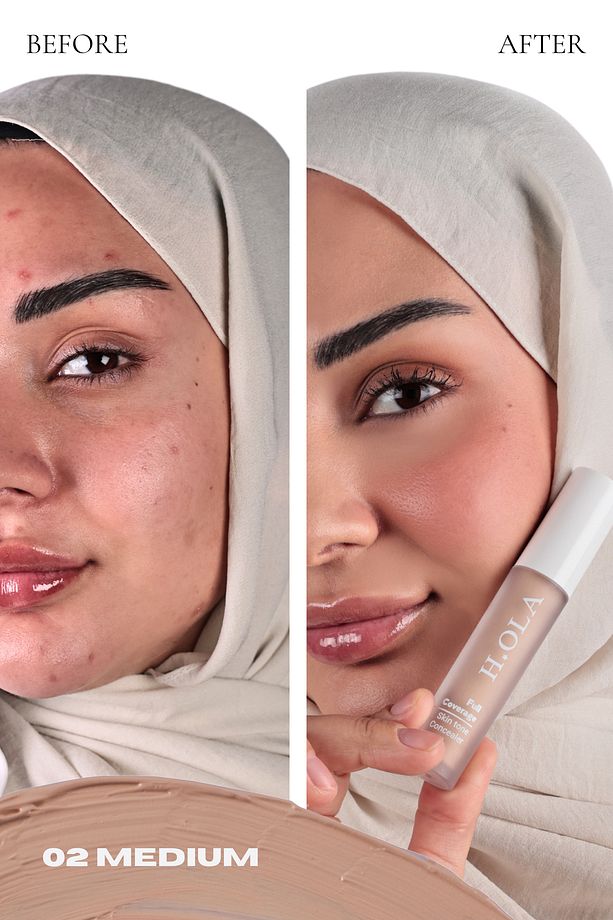 Cover All Yoğun Kapatıcı | Full Coverage Concealer -medium - 3