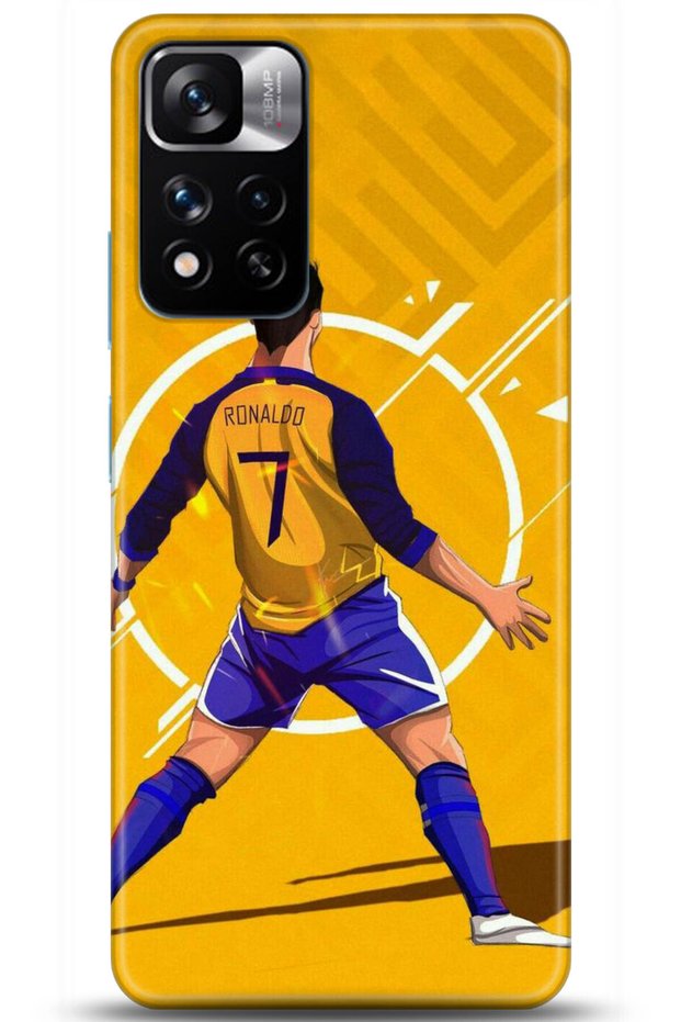 Xiaomi Redmi Note 11 Pro Plus 5g Case Hd Printed Case - Like You Series 5093