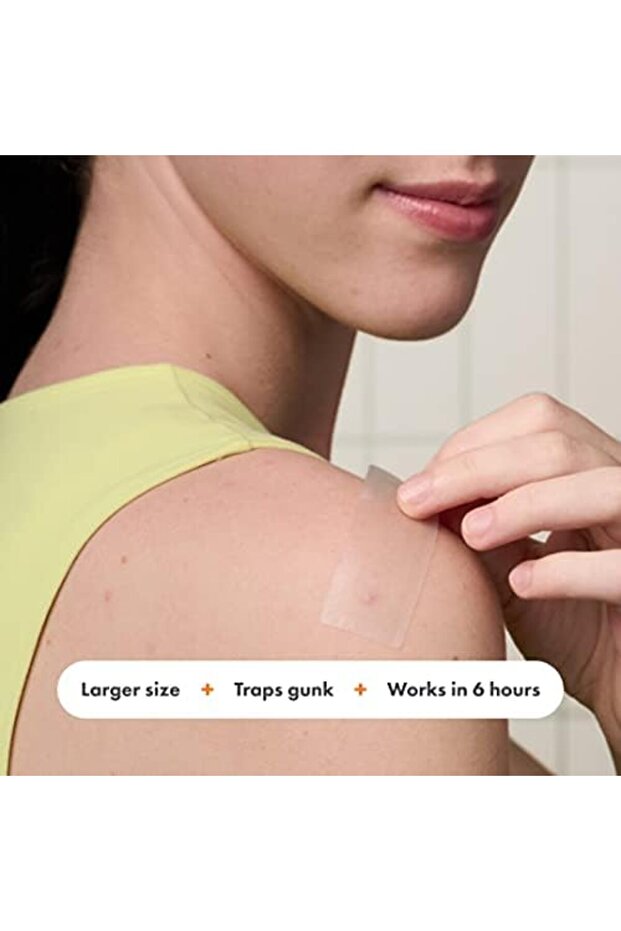 السطح - رقعة هيدروكولويد لعلاج حب الشباب الكبير (10 قطع) - 4