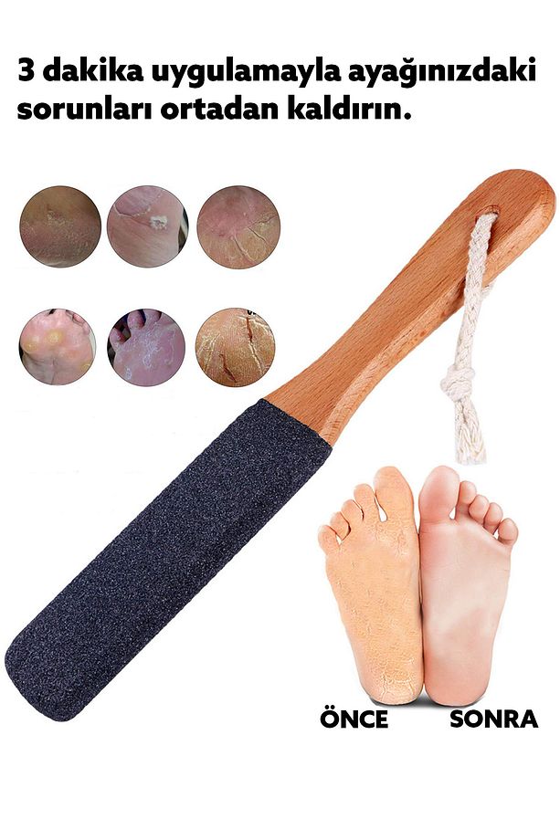 Ayak Törpüsü Çift Taraflı Ahşap Saplı Ayak Ve Topuk Törpüsü Bakım Aparatı Ölü Deri Temizleyici - 4