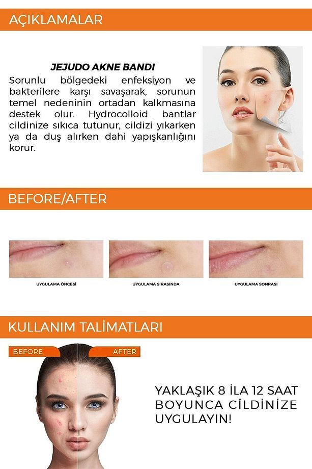 Ceuticals Original Pimple Patch 36 Patch - Akne Ve Sivilce Bandı - 7