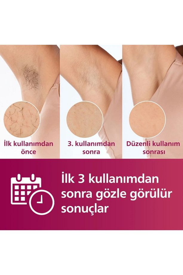 Lumea Kablosuz Premium Lazer Epilasyon Full Set Lambader Hediyeli - 5
