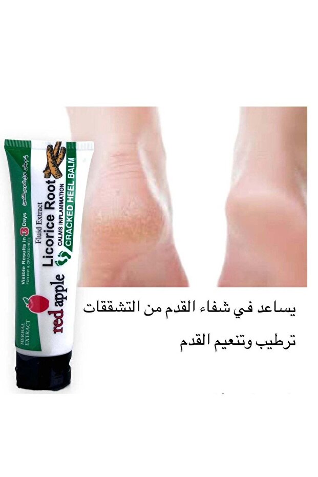 بلسم القدم بجذر عرق السوس الطبيعي