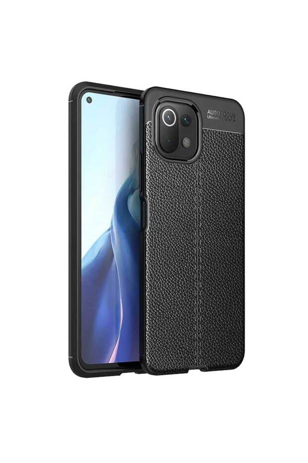 حافظة سيليكون لهاتف Xiaomi Mi 11 بمظهر جلدي