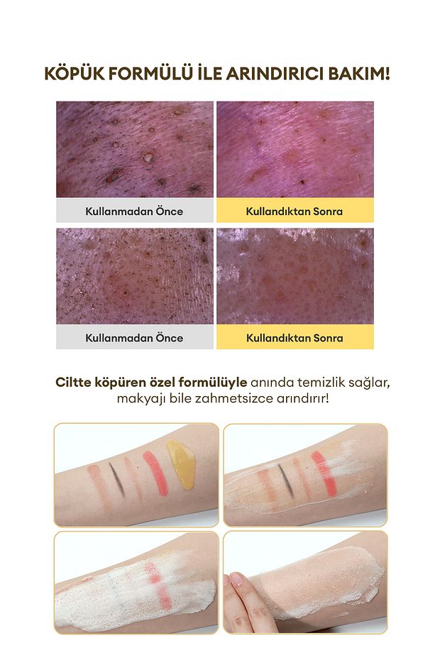 Ciltte Köpüren Jel Temizleyici & Maske Vita C Plus All In One Pack Foam Cleanser 200 ml - 5