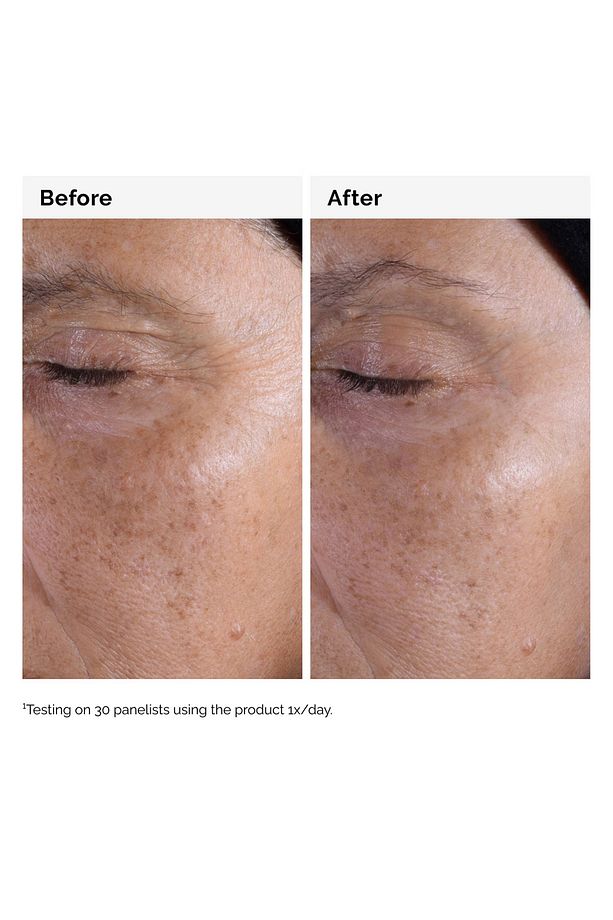 Glycolic Acid 7% Toning Solution - Aydınlatmaya ve Pürüzsüzleştirmeye Yardımcı 100 ml - 3
