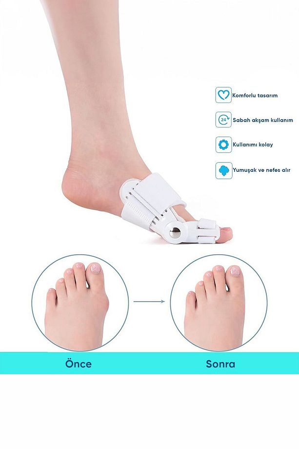 Ayak Baş Parmak Kemik Düzeltici Ayak Parmağı Halluks Valgus Ateli Bunyon Eğrilik Aparat - 7