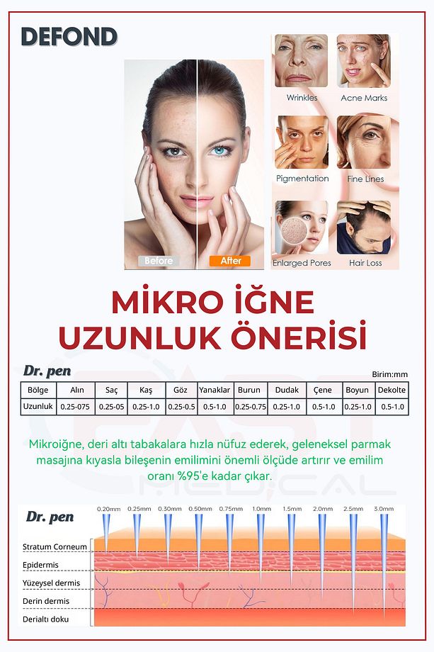 Dr Pen A6-a10-a1-n2-m5-m7-e30-mym Uyumlu Iğneleri 10 Adet 36 Pin Orijinal Dermapen Iğne Kartuşu - 3