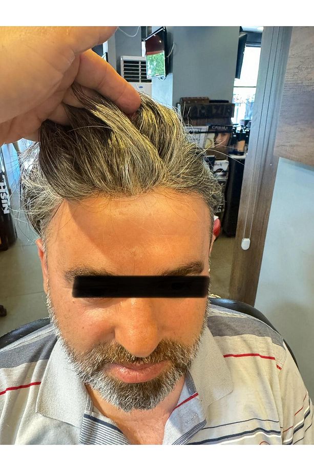 Protez Saç New Avusturya - 6x9 - Renk Gri İnce Telli Her Yöne Taranabilen Alt Yapı %100 İnsan Saçı - 3