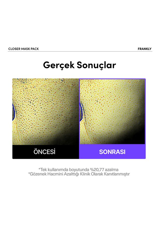 Pirinç Özü, Peptit ve Kolajen İçeren Gözenek Sıkılaştırıcı Kağıt Maske - 2