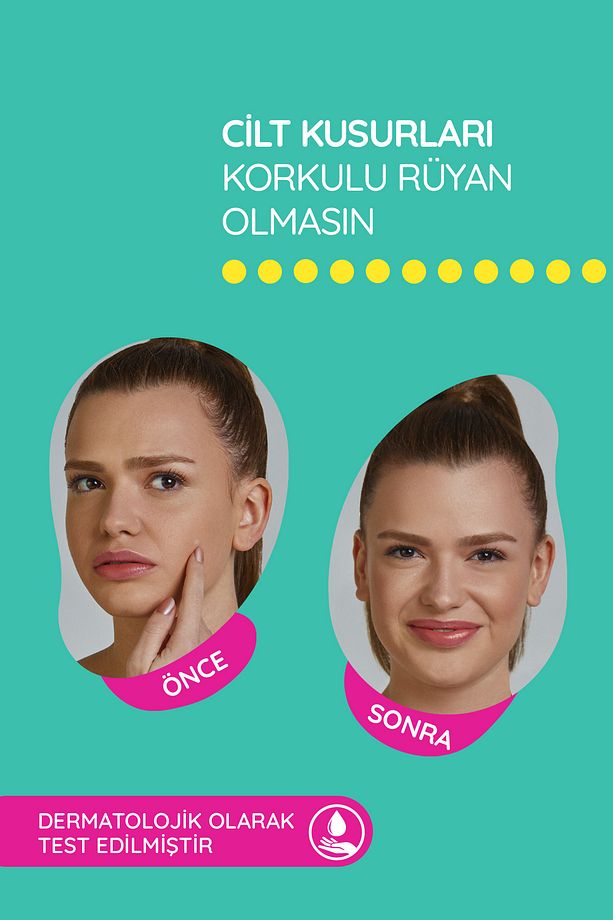 S.o.s Mixy | 24’lü Yüz Için Sivilce/akne Bandı–4 Boy Pimple Patch-hidrokolloid Bant - 5