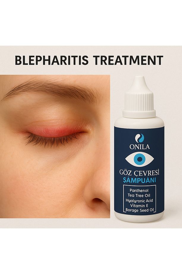 Göz Çevresi Şampuanı 50 ml ( Göz Kapağı, Kaş Ve Kirpik Diplerinin Temizliğinde) 07/2026 - 1