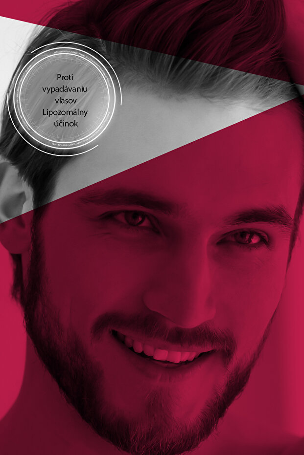 Forte 300 ml šampón - intenzívny šampón proti vypadávaniu vlasov pre všetky typy vlasov - 3